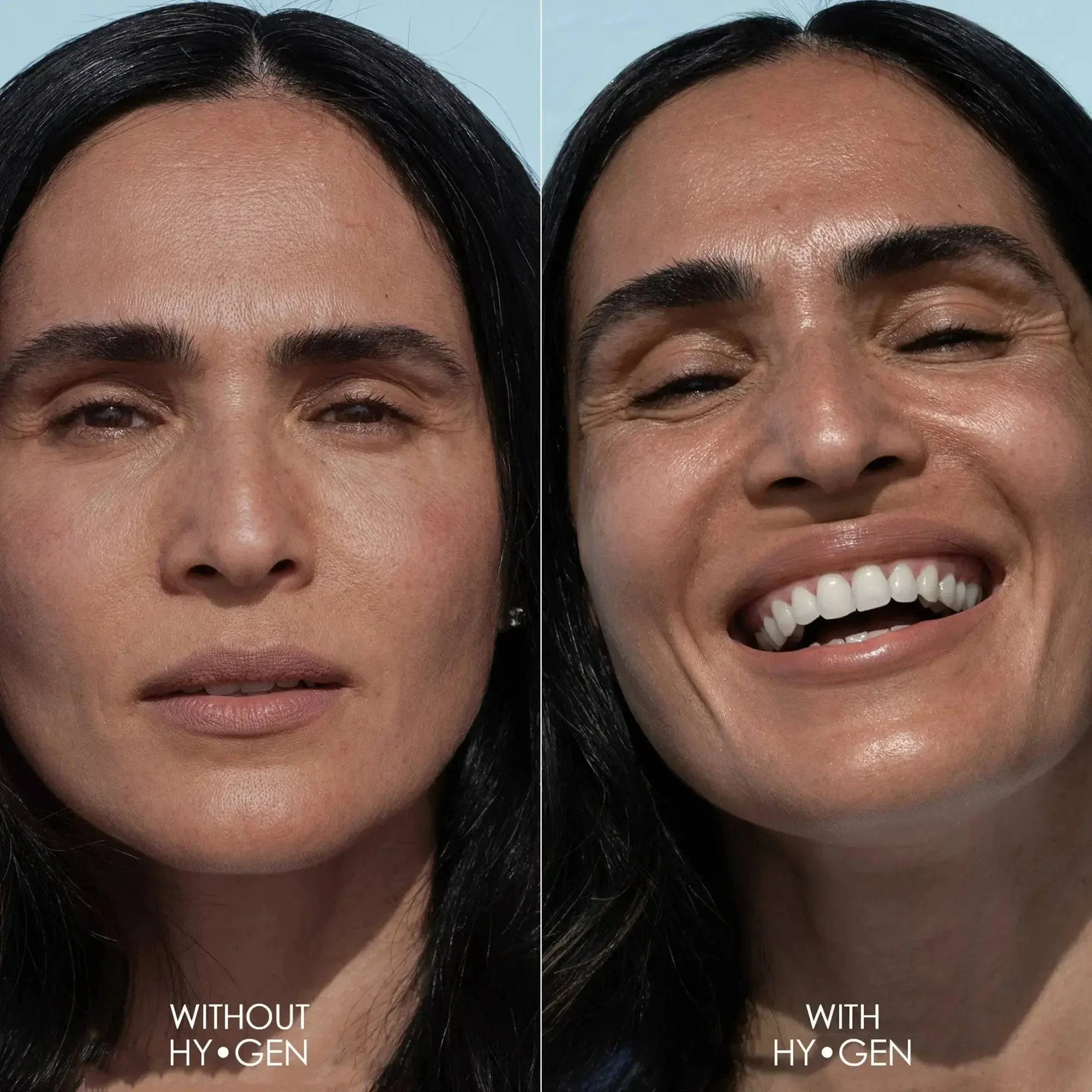 HY-GEN PRIMER SERUM - היי-ג’ן פריימר סרום - Image 3